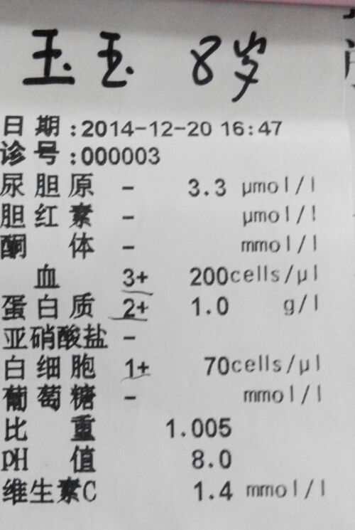 尿常規(guī)檢查