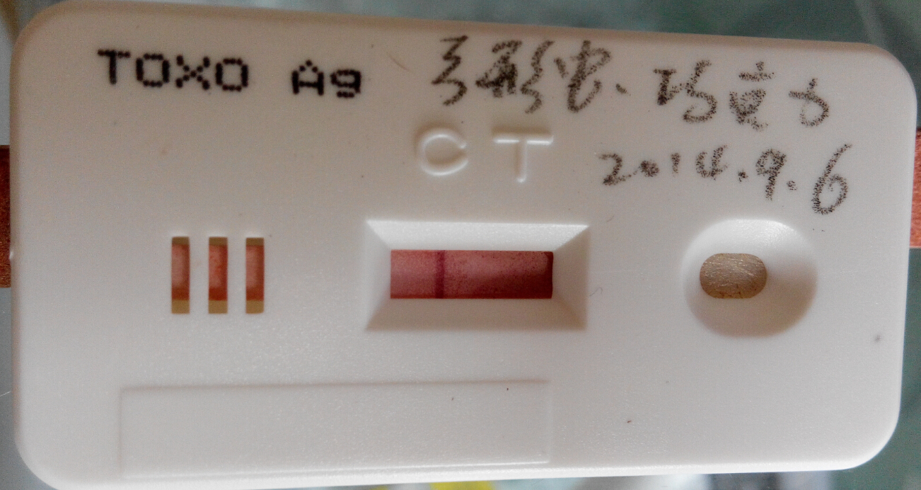 弓形蟲(chóng)檢測(cè)