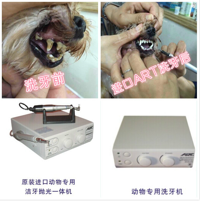 洗牙，潔牙